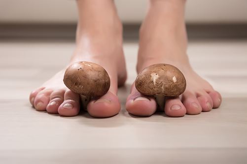 Athlete’s Foot: The Best Home Remedies